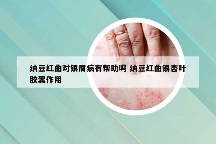 纳豆红曲对银屑病有帮助吗 纳豆红曲银杏叶胶囊作用