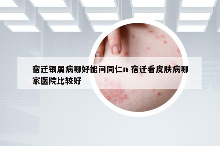 宿迁银屑病哪好能问同仁n 宿迁看皮肤病哪家医院比较好