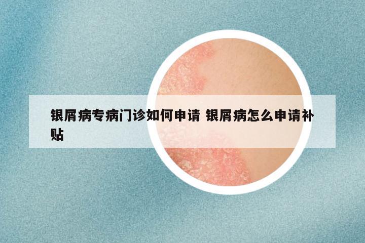 银屑病专病门诊如何申请 银屑病怎么申请补贴