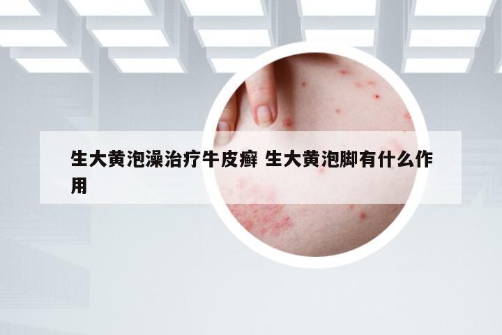 生大黄泡澡治疗牛皮癣 生大黄泡脚有什么作用