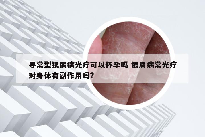 寻常型银屑病光疗可以怀孕吗 银屑病常光疗对身体有副作用吗?