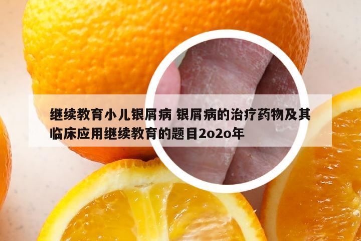 继续教育小儿银屑病 银屑病的治疗药物及其临床应用继续教育的题目2o2o年