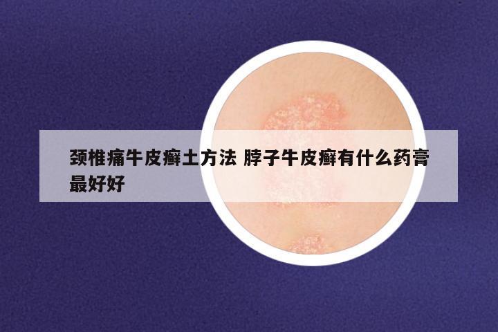 颈椎痛牛皮癣土方法 脖子牛皮癣有什么药膏最好好