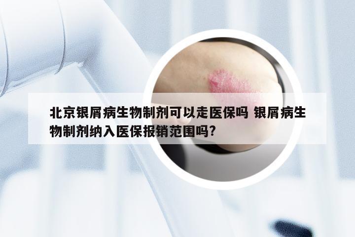 北京银屑病生物制剂可以走医保吗 银屑病生物制剂纳入医保报销范围吗?