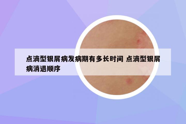点滴型银屑病发病期有多长时间 点滴型银屑病消退顺序