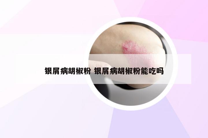 银屑病胡椒粉 银屑病胡椒粉能吃吗