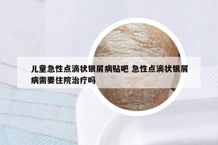 儿童急性点滴状银屑病贴吧 急性点滴状银屑病需要住院治疗吗