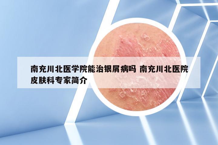 南充川北医学院能治银屑病吗 南充川北医院皮肤科专家简介