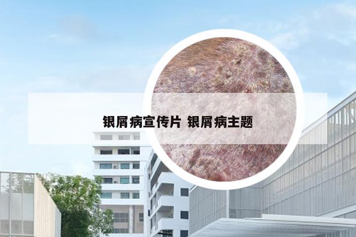 银屑病宣传片 银屑病主题