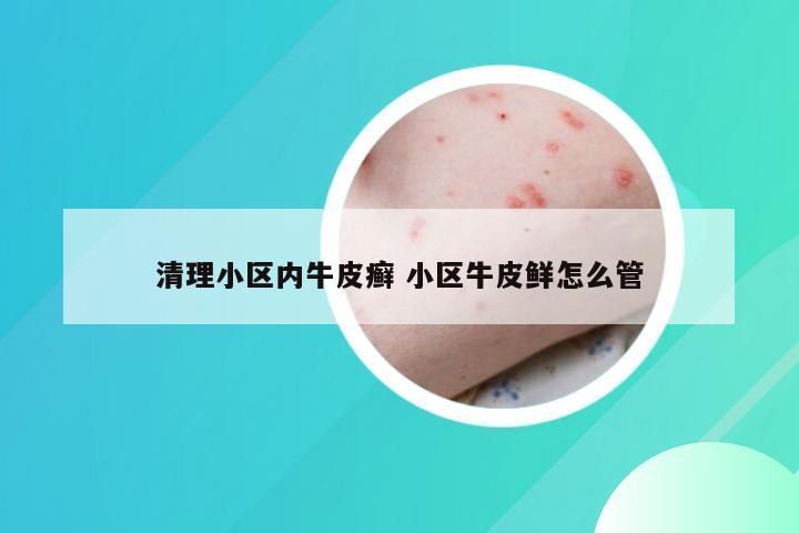 清理小区内牛皮癣 小区牛皮鲜怎么管
