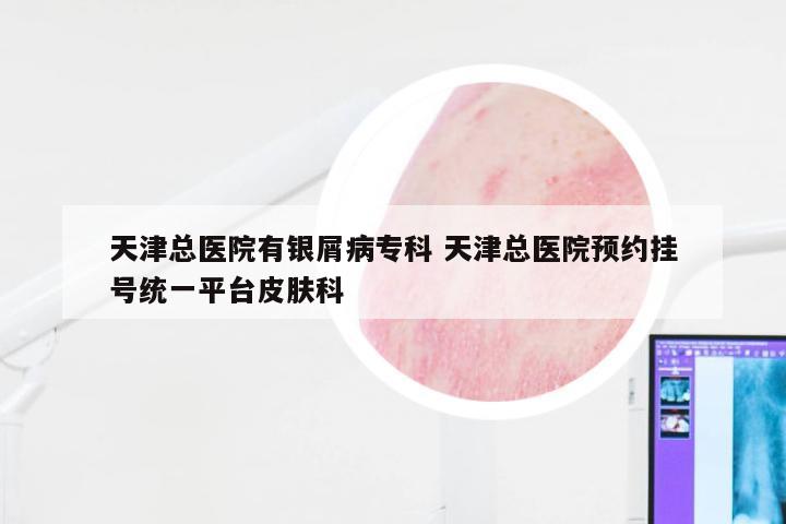 天津总医院有银屑病专科 天津总医院预约挂号统一平台皮肤科