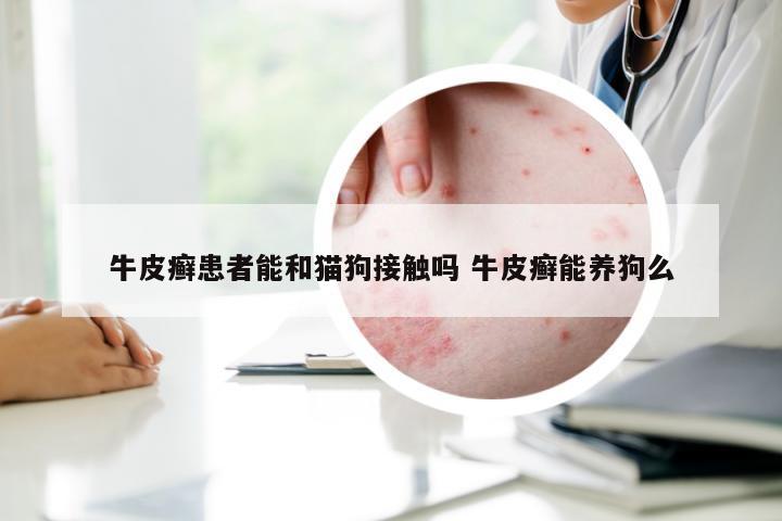 牛皮癣患者能和猫狗接触吗 牛皮癣能养狗么