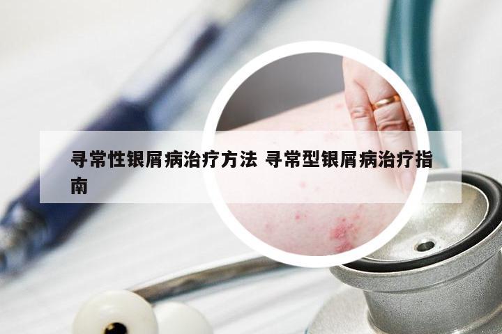 寻常性银屑病治疗方法 寻常型银屑病治疗指南
