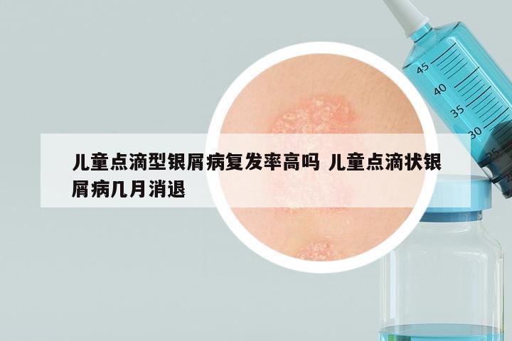 儿童点滴型银屑病复发率高吗 儿童点滴状银屑病几月消退