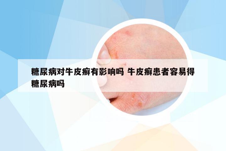 糖尿病对牛皮癣有影响吗 牛皮癣患者容易得糖尿病吗