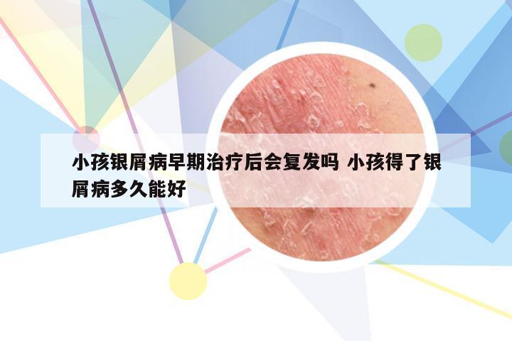 小孩银屑病早期治疗后会复发吗 小孩得了银屑病多久能好