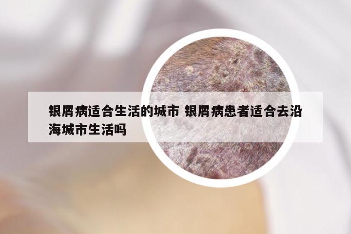 银屑病适合生活的城市 银屑病患者适合去沿海城市生活吗