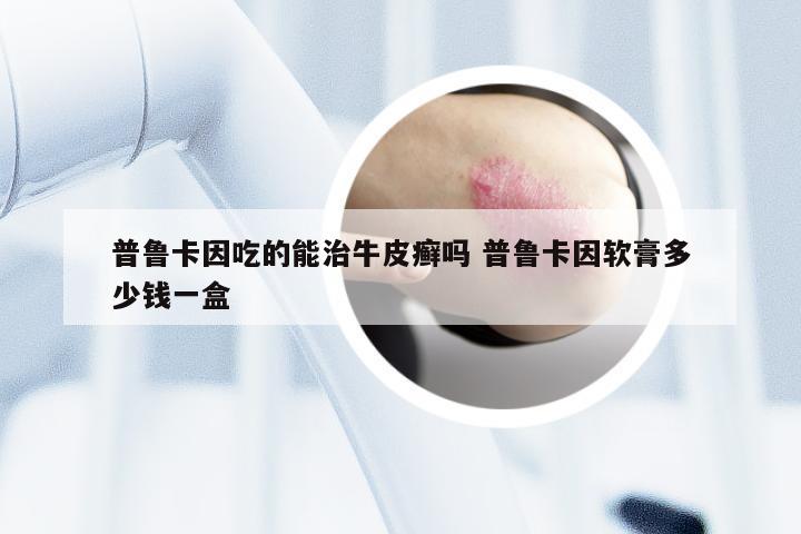 普鲁卡因吃的能治牛皮癣吗 普鲁卡因软膏多少钱一盒