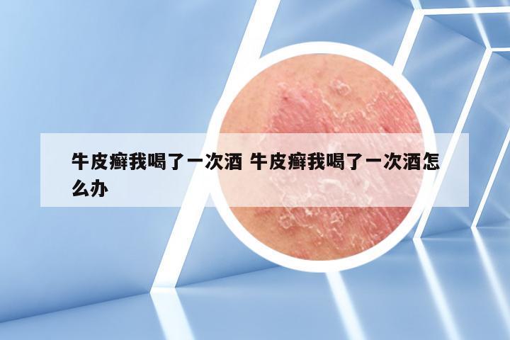 牛皮癣我喝了一次酒 牛皮癣我喝了一次酒怎么办