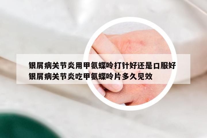 银屑病关节炎用甲氨蝶呤打针好还是口服好 银屑病关节炎吃甲氨蝶呤片多久见效