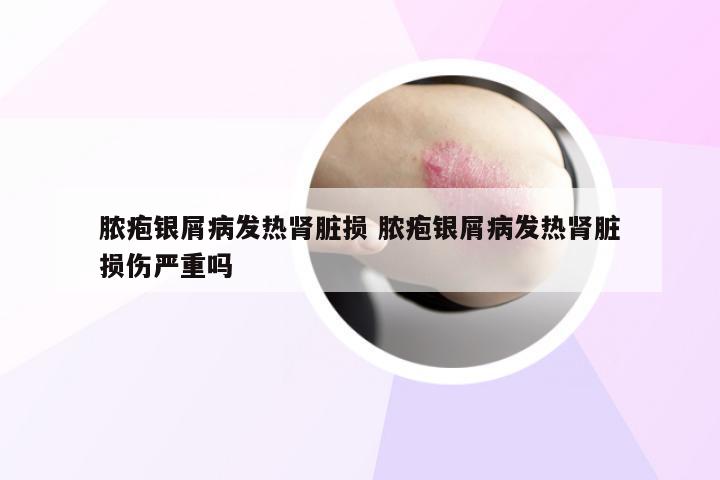 脓疱银屑病发热肾脏损 脓疱银屑病发热肾脏损伤严重吗