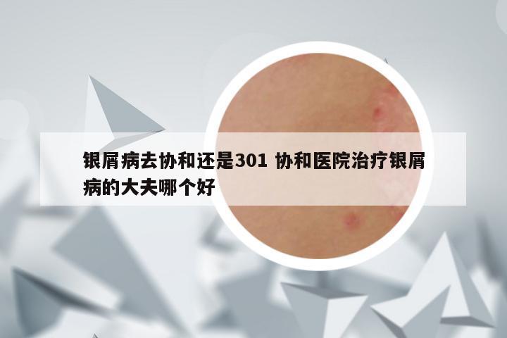银屑病去协和还是301 协和医院治疗银屑病的大夫哪个好