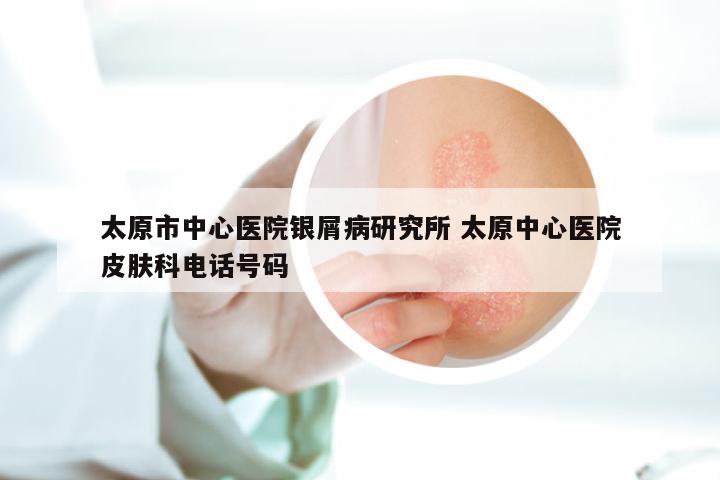 太原市中心医院银屑病研究所 太原中心医院皮肤科电话号码