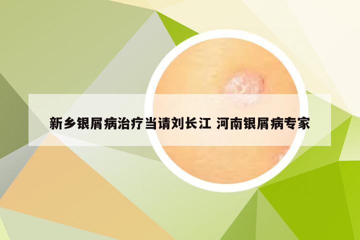 新乡银屑病治疗当请刘长江 河南银屑病专家