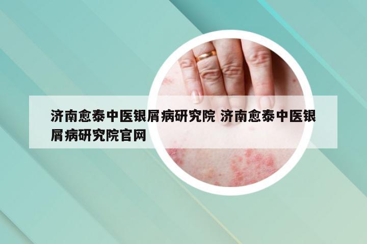 济南愈泰中医银屑病研究院 济南愈泰中医银屑病研究院官网