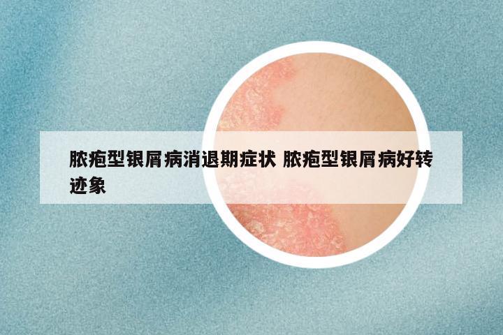脓疱型银屑病消退期症状 脓疱型银屑病好转迹象