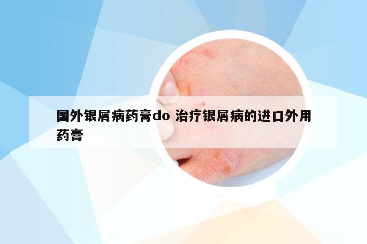 国外银屑病药膏do 治疗银屑病的进口外用药膏
