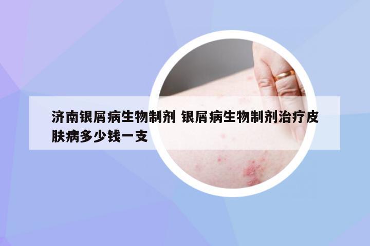 济南银屑病生物制剂 银屑病生物制剂治疗皮肤病多少钱一支