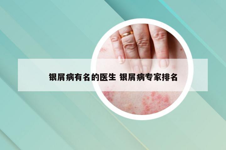 银屑病有名的医生 银屑病专家排名