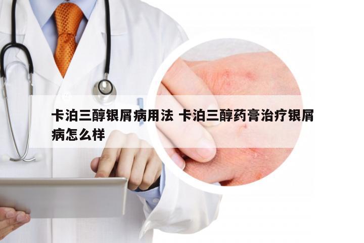 卡泊三醇银屑病用法 卡泊三醇药膏治疗银屑病怎么样