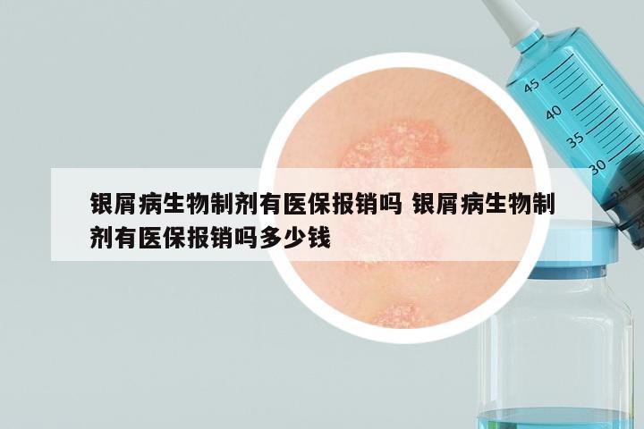 银屑病生物制剂有医保报销吗 银屑病生物制剂有医保报销吗多少钱