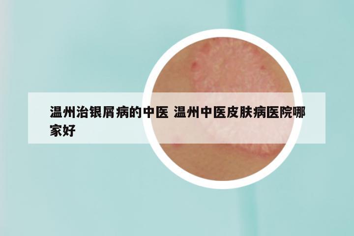 温州治银屑病的中医 温州中医皮肤病医院哪家好