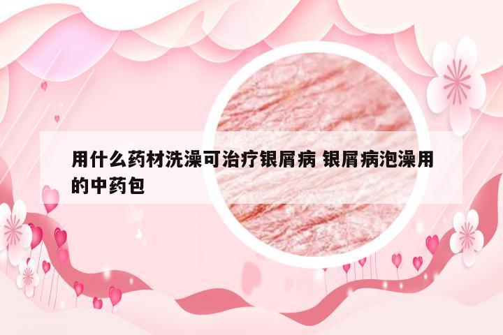 用什么药材洗澡可治疗银屑病 银屑病泡澡用的中药包