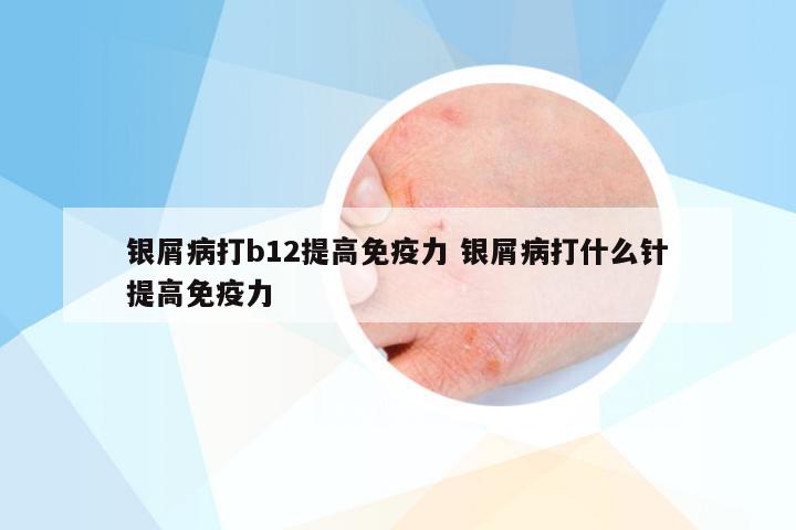 银屑病打b12提高免疫力 银屑病打什么针提高免疫力