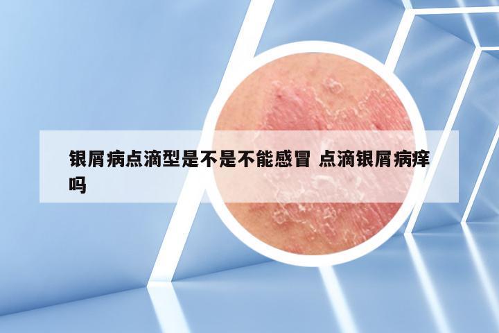 银屑病点滴型是不是不能感冒 点滴银屑病痒吗