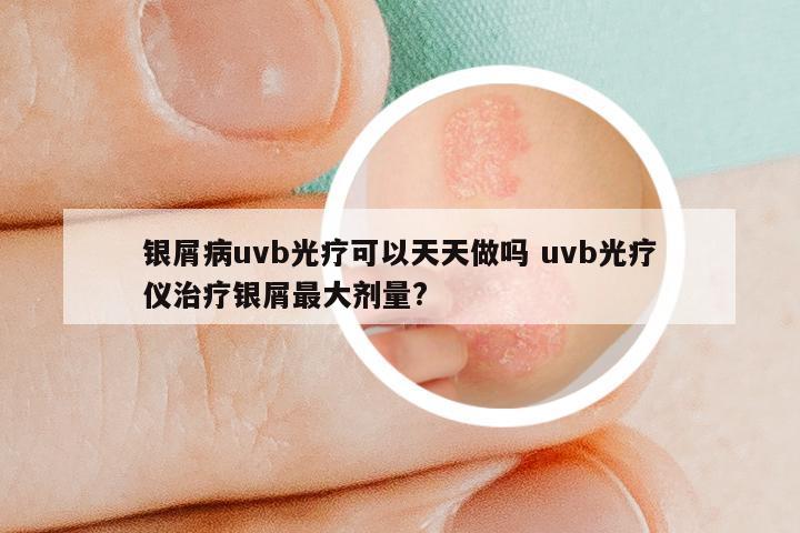 银屑病uvb光疗可以天天做吗 uvb光疗仪治疗银屑最大剂量?