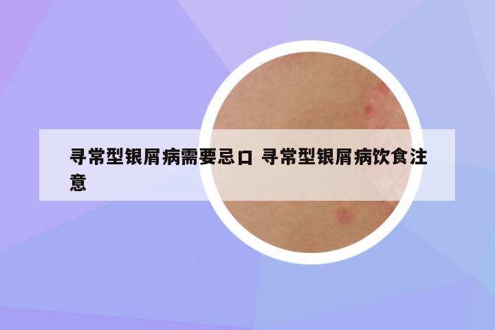 寻常型银屑病需要忌口 寻常型银屑病饮食注意