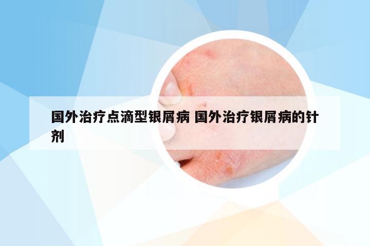 国外治疗点滴型银屑病 国外治疗银屑病的针剂