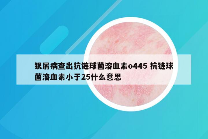 银屑病查出抗链球菌溶血素o445 抗链球菌溶血素小于25什么意思