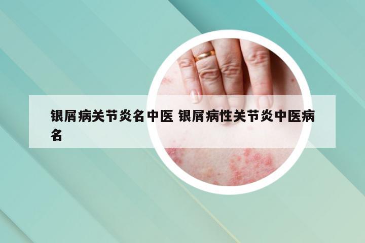 银屑病关节炎名中医 银屑病性关节炎中医病名