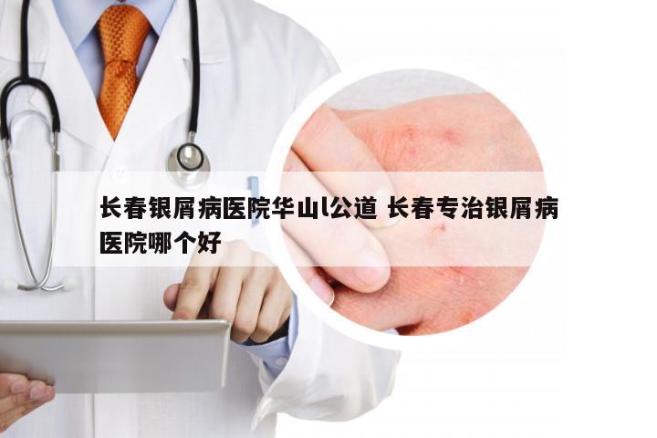 长春银屑病医院华山l公道 长春专治银屑病医院哪个好