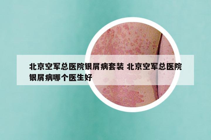 北京空军总医院银屑病套装 北京空军总医院银屑病哪个医生好
