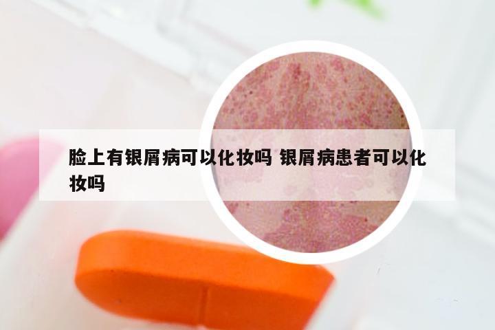 脸上有银屑病可以化妆吗 银屑病患者可以化妆吗