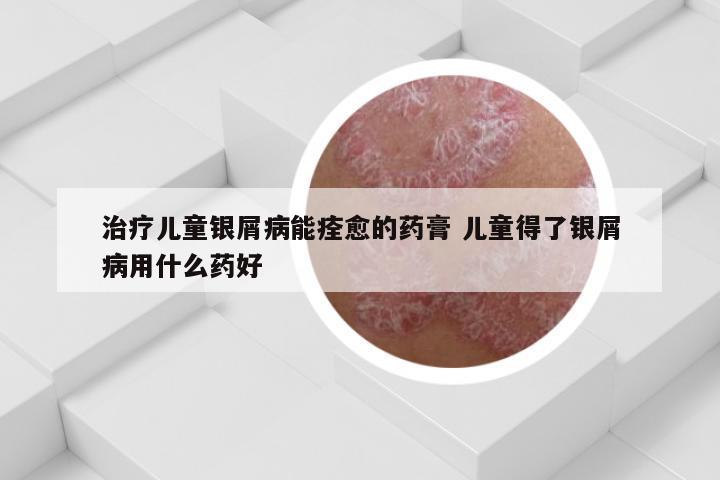 治疗儿童银屑病能痊愈的药膏 儿童得了银屑病用什么药好