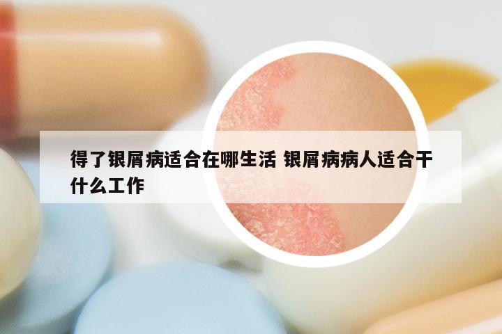 得了银屑病适合在哪生活 银屑病病人适合干什么工作