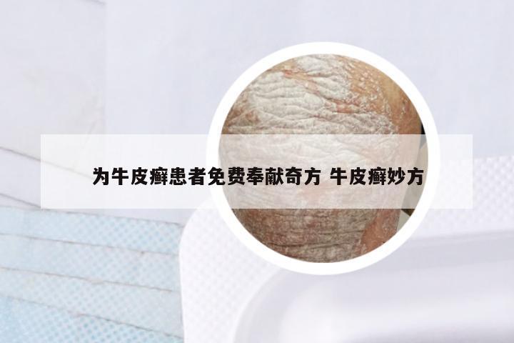 为牛皮癣患者免费奉献奇方 牛皮癣妙方